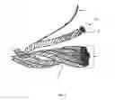 Fig. 04 - Durable insect netting