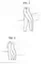 Fig. 02 - Zip-away Athletic tights