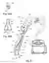 Fig. 19 - SURFACE CLEANING APPARATUS