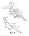 Fig. 03 - Cleaning attachment for a utility bucket