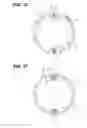 Fig. 12 - ENDOSCOPE
