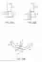 Fig. 34 - Tissue Visualization Device And Method Variations