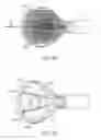 Fig. 47 - Tissue Visualization Device And Method Variations