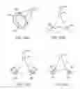 Fig. 51 - Tissue Visualization Device And Method Variations