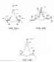 Fig. 52 - Tissue Visualization Device And Method Variations