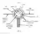 Fig. 03 - Systems, methods and devices for performing water aided endoscopy