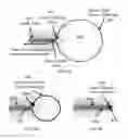 Fig. 09 - Systems, methods and devices for performing water aided endoscopy