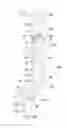 Fig. 14 - Medical devices and methods of placement