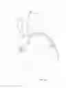 Fig. 56 - Medical devices and methods of placement