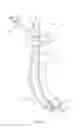 Fig. 58 - Medical devices and methods of placement