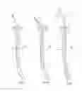 Fig. 59 - Medical devices and methods of placement