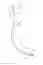 Fig. 65 - Medical devices and methods of placement