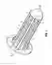 Fig. 02 - Anoscope