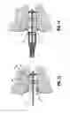 Fig. 09 - Anoscope