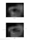 Fig. 03 - Systems and methods for improved ease and accuracy of gaze tracking