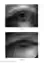 Fig. 06 - Systems and methods for improved ease and accuracy of gaze tracking