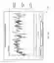 Fig. 15 - Rapid detection of bleeding before, during, and after fluid resuscitation
