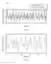 Fig. 06 - Motion artifact removal by time domain projection