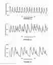 Fig. 03 - Method and system for detecting heartbeat irregularities
