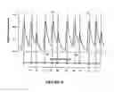 Fig. 05 - Method and system for detecting heartbeat irregularities