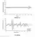 Fig. 06 - Method and system for detecting heartbeat irregularities