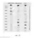 Fig. 12 - Neurophysiological data analysis using spatiotemporal parcellation