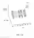 Fig. 16 - Neurophysiological data analysis using spatiotemporal parcellation