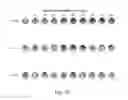Fig. 34 - Neurophysiological data analysis using spatiotemporal parcellation