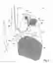 Fig. 03 - Method and apparatus for endobronchial diagnosis