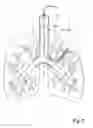 Fig. 07 - Method and apparatus for endobronchial diagnosis