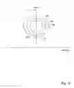 Fig. 11 - Method and apparatus for endobronchial diagnosis