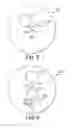 Fig. 05 - SAMPLING DEVICES AND METHODS INVOLVING RELATIVELY LITTLE PAIN