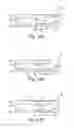 Fig. 13 - SAMPLING DEVICES AND METHODS INVOLVING RELATIVELY LITTLE PAIN