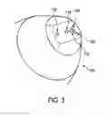 Fig. 04 - Apparatus for determining a property of a tissue