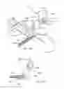 Fig. 28 - Micro vein enhancer with a dual buffer mode of operation