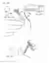 Fig. 31 - Micro vein enhancer with a dual buffer mode of operation