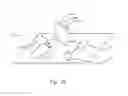 Fig. 42 - Micro vein enhancer with a dual buffer mode of operation