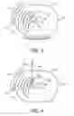Fig. 04 - Real time energy depositing therapy system controlled by magnetic resonance rheology
