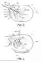 Fig. 05 - Real time energy depositing therapy system controlled by magnetic resonance rheology