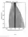 Fig. 08 - Method and apparatus for determining the location of a medical instrument with respect to ultrasound imaging, and a medical instrument to facilitate such determination