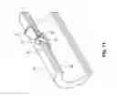 Fig. 13 - Vessel sealing device