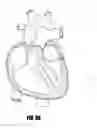 Fig. 07 - CATHETER-BASED TISSUE REMODELING DEVICES AND METHODS