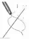 Fig. 08 - Multiple-firing suture fixation device and methods for using and manufacturing same