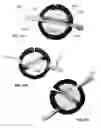Fig. 76 - Multiple-firing suture fixation device and methods for using and manufacturing same