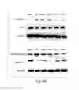 Fig. 06 - Use of remote ischemic conditioning to improve outcome after myocardial infarction