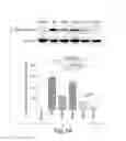 Fig. 08 - Use of remote ischemic conditioning to improve outcome after myocardial infarction