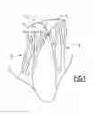 Fig. 02 - Bodily tissue treatment kit