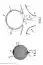 Fig. 03 - Electrolytic and mechanical detachment for implant delivery systems