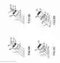 Fig. 05 - Electrolytic and mechanical detachment for implant delivery systems