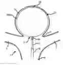 Fig. 01 - Electrolytic detachment elements for implant delivery systems